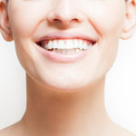 a woman with porcelain veneers