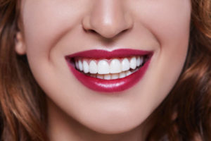 Woman with white teeth